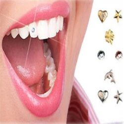 dental jewellery